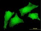 CRKL Antibody (monoclonal) (M03)