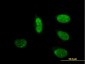 CRSP6 Antibody (monoclonal) (M01)