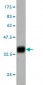 CRSP6 Antibody (monoclonal) (M01)