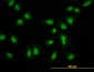 CRSP6 Antibody (monoclonal) (M02)