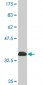 CRSP7 Antibody (monoclonal) (M06)