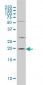 CRYAB Antibody (monoclonal) (M01)