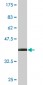 CRYM Antibody (monoclonal) (M09)