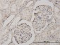 CSDA Antibody (monoclonal) (M02)