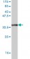 CSDA Antibody (monoclonal) (M02)