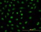 CSDA Antibody (monoclonal) (M06)