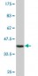 CSDA Antibody (monoclonal) (M06)