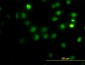 CSE1L Antibody (monoclonal) (M01)