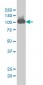 CSE1L Antibody (monoclonal) (M03)