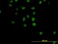 CSE1L Antibody (monoclonal) (M04)