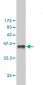 CSE1L Antibody (monoclonal) (M04)