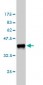 CSF1 Antibody (monoclonal) (M01)