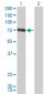 CSF1 Antibody (monoclonal) (M01)