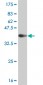 CSNK2A1 Antibody (monoclonal) (M01)