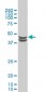 CSNK2A1 Antibody (monoclonal) (M01)