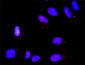 CSNK2A1 Antibody (monoclonal) (M01)