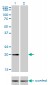 CSRP3 Antibody (monoclonal) (M03)