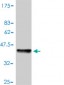 CSTB Antibody (monoclonal) (M01)