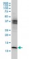 CSTB Antibody (monoclonal) (M01)