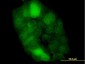 CSTB Antibody (monoclonal) (M02)