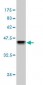 CSTB Antibody (monoclonal) (M02)