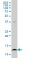 CSTB Antibody (monoclonal) (M02)