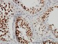CSTF3 Antibody (monoclonal) (M01)