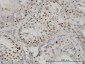 CTBP1 Antibody (monoclonal) (M01)