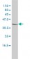 CTBS Antibody (monoclonal) (M01)