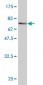 CTH Antibody (monoclonal) (M03)