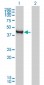 CTH Antibody (monoclonal) (M03)