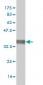 CTLA4 Antibody (monoclonal) (M08)