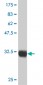 CTNNB1 Antibody (monoclonal) (M02)