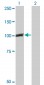 CTNNB1 Antibody (monoclonal) (M02)