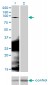 CTNNB1 Antibody (monoclonal) (M02)