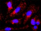 CTNNB1 Antibody (monoclonal) (M02)