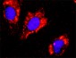 CTNNB1 Antibody (monoclonal) (M02)