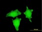 CTNNB1 Antibody (monoclonal) (M07)