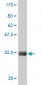 CTNNB1 Antibody (monoclonal) (M07)