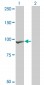 CTNNB1 Antibody (monoclonal) (M07)