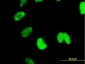 CTNNBL1 Antibody (monoclonal) (M01)