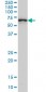 CTNNBL1 Antibody (monoclonal) (M01)