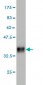 CTNS Antibody (monoclonal) (M09)