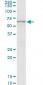 CTNS Antibody (monoclonal) (M09)