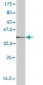 CTSK Antibody (monoclonal) (M01)