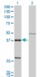 CTSK Antibody (monoclonal) (M01)