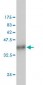 CUL7 Antibody (monoclonal) (M01)