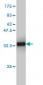 CX3CR1 Antibody (monoclonal) (M01)