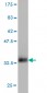 CXCL1 Antibody (monoclonal) (M01)