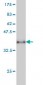 CXCL5 Antibody (monoclonal) (M03)